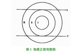\ՄĤօ^(q)ּR(yng)